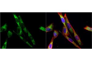 ICC/IF Image Tyrosine Hydroxylase antibody [N1C1] detects Tyrosine Hydroxylase protein at cytoplasm by immunofluorescent analysis. (Tyrosine Hydroxylase anticorps)