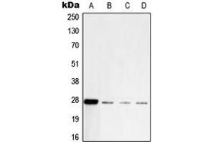 Western blot analysis of PGP9. (UCHL1 anticorps  (C-Term))