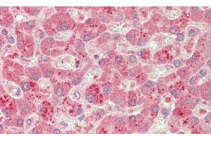 Detection of C5a in Human Liver Tissue using Monoclonal Antibody to Complement Component 5a (C5a)