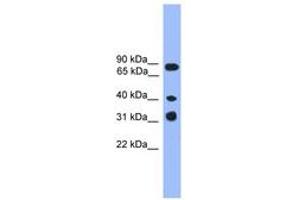 Image no. 1 for anti-Lymphocyte Transmembrane Adaptor 1 (LAX1) (C-Term) antibody (ABIN6745351) (LAX1 anticorps  (C-Term))
