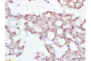 Formalin-fixed and paraffin embedded rat lung tissue labeled with Anti-PAX2 Polyclonal Antibody, Unconjugated (ABIN738951) at 1:200 followed by conjugation to the secondary antibody and DAB staining (PAX2A anticorps)