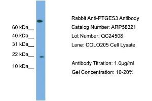 WB Suggested Anti-PTGES3  Antibody Titration: 0. (PTGES3 anticorps  (Middle Region))