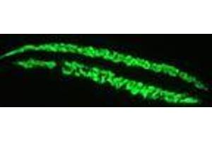 Image no. 1 for anti-Actin, Alpha, Cardiac Muscle 1 (ACTC1) antibody (ABIN959519)