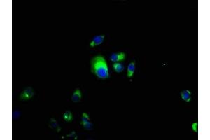 Immunofluorescence staining of MCF-7 cells with ABIN7149290 at 1:66, counter-stained with DAPI.