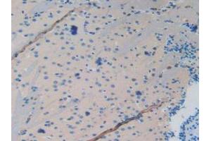 IHC-P analysis of Mouse Brain Tissue, with DAB staining. (MAPT anticorps  (AA 92-400))