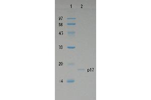 SDS-PAGE (SDS) image for Human Immunodeficiency Virus 1 Matrix (HIV-1 p17) protein (ABIN2452193) (HIV-1 p17 Protéine)