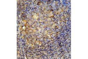 Immunohistochemistry analysis in formalin fixed and paraffin embedded human tonsil tissue reacted with CD10 / Neprilysin Antibody (Center) followed by peroxidase conjugation of the secondary antibody and DAB staining. (MME anticorps  (Middle Region))
