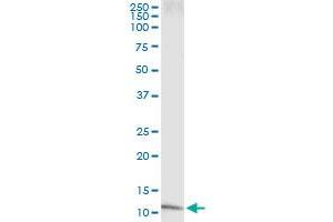 IL8 (Human) IP-WB Antibody Pair