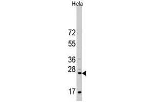 Western blot analysis of CD8A polyclonal antibody  in HeLa cell line lysates (35 ug/lane). (CD8 alpha anticorps  (N-Term))