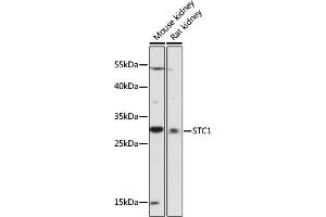 Western blot analysis of extracts of various cell lines, using STC1 antibody (ABIN7270583) at 1:1000 dilution.
