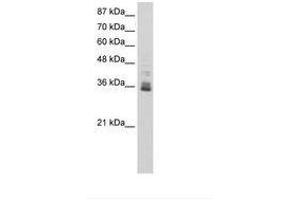 Image no. 1 for anti-Zinc Finger Protein 197 (ZNF197) (N-Term) antibody (ABIN6736240) (ZNF197 anticorps  (N-Term))