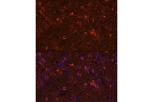 Immunofluorescence analysis of rat brain using G Rabbit pAb (ABIN3021187, ABIN3021188, ABIN3021189 and ABIN6214056) at dilution of 1:100 (40x lens).
