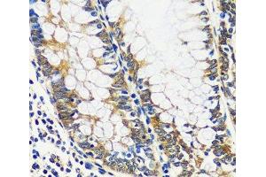 Immunohistochemistry of paraffin-embedded Human colon using CCDC124 Polyclonal Antibody at dilution of 1:100 (40x lens). (CCDC124 anticorps)