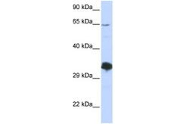 ZNF630 Antikörper  (C-Term)