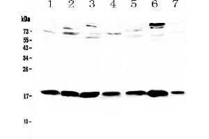 WFDC2 anticorps  (AA 31-168)