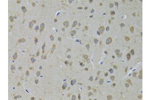Immunohistochemistry of paraffin-embedded rat brain using ADH5 antibody (ABIN6292597) at dilution of 1:100 (40x lens). (ADH5 anticorps)