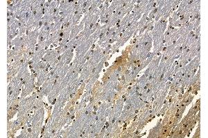 ABIN6262437 and ABIN6278874 at 1/100 staining rat brain tissue by IHC-P.