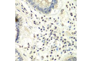 Immunohistochemistry of paraffin-embedded human colon using PRMT5 antibody at dilution of 1:100 (x40 lens). (PRMT5 anticorps)