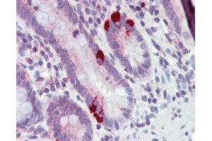 Immunohistochemistry (IHC) image for anti-Solute Carrier Family 39 (Metal Ion Transporter), Member 5 (SLC39A5) (N-Term) antibody (ABIN2781736)