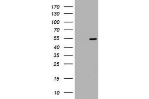Image no. 1 for anti-Vimentin (VIM) (AA 210-466) antibody (ABIN1491205) (Vimentin anticorps  (AA 210-466))