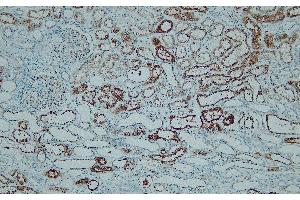 Immunohistochemistry (IHC) image for anti-Napsin A Aspartic Peptidase (NAPSA) (N-Term) antibody (ABIN7598894)