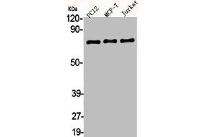 Western Blot analysis of PC12 MCF7 Jurkat cells using AKAP 95 Polyclonal Antibody (AKAP8 anticorps  (Internal Region))