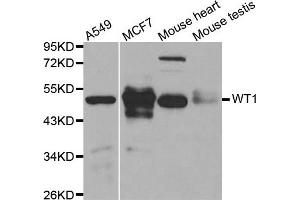 Western blot analysis of extracts of various cell lines, using WT1 antibody. (WT1 anticorps)