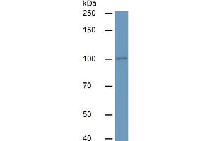 Rabbit Detection antibody from the kit in WB with Positive Control:  Sample Human serum.