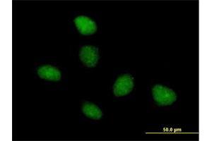 Immunofluorescence of purified MaxPab antibody to TAF15 on HeLa cell. (TAF15 anticorps  (AA 1-592))
