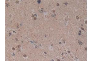 Detection of MFAP2 in Human Brain Tissue using Polyclonal Antibody to Microfibrillar Associated Protein 2 (MFAP2)