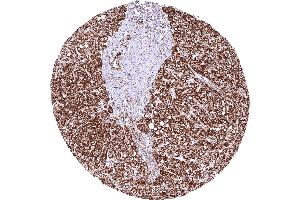 Liver with intense cytoplasmic SDHB staining of hepatocytes while other cell types show less staining