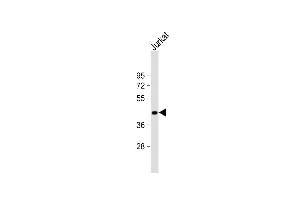 Anti-ST3GAL5 Antibody (C-term) at 1:1000 dilution + Jurkat whole cell lysate Lysates/proteins at 20 μg per lane. (ST3GAL5 anticorps  (AA 389-418))
