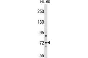 Western blot analysis in HL-60 cell line lysates (35ug/lane) using MTMR6 Antibody (N-term). (MTMR6 anticorps  (N-Term))