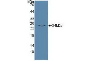 Western blot analysis of recombinant Human PANX1. (PANX1 anticorps  (AA 228-411))