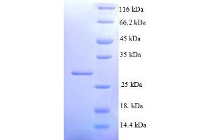 SDS-PAGE (SDS) image for Potassium Inwardly-Rectifying Channel, Subfamily J, Member 1 (KCNJ1) (AA 178-391), (Cytoplasmic Domain), (Cytosolic) protein (His tag) (ABIN5709793)