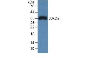 Detection of Recombinant Ceruloplasmin, Human using Monoclonal Antibody to Ceruloplasmin (CP)