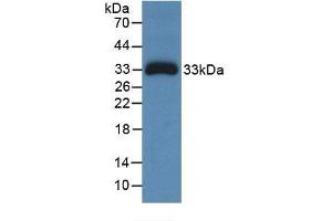 Detection of Recombinant Ceruloplasmin, Human using Monoclonal Antibody to Ceruloplasmin (CP) (Ceruloplasmin anticorps  (AA 789-1065))