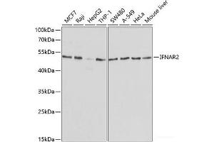 Western blot analysis of extracts of various cell lines using IFNAR2 Polyclonal Antibody at dilution of 1:1000. (IFNAR2 anticorps)