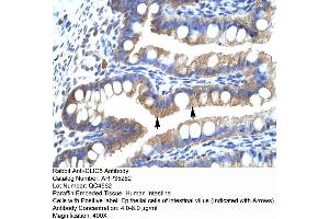 Human Intestine (CLIC5 anticorps  (Middle Region))