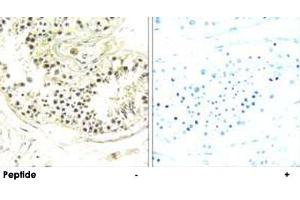 Immunohistochemistry analysis of paraffin-embedded human testis tissue using DYNLRB2 polyclonal antibody . (DYNLRB2 anticorps)