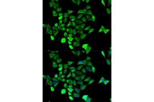 Immunofluorescence analysis of HeLa cell using KCNN4 antibody. (KCNN4 anticorps  (AA 288-427))