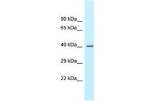 Image no. 1 for anti-Glycine C-Acetyltransferase (GCAT) (AA 219-268) antibody (ABIN6747617) (GCAT anticorps  (AA 219-268))