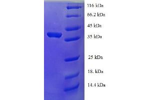 SDS-PAGE (SDS) image for Upstream Transcription Factor 1 (USF1) (AA 3-310), (partial) protein (His tag) (ABIN5710600)