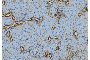 ABIN6272875 at 1/100 staining Mouse kidney tissue by IHC-P. (CAMSAP2 anticorps  (C-Term))