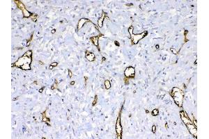 IHC analysis of HBD using anti-HBD antibody .