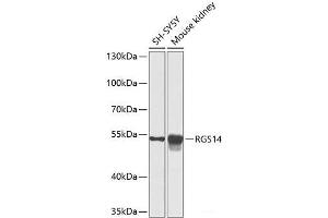 Western blot analysis of extracts of various cell lines using RGS14 Polyclonal Antibody at dilution of 1:1000. (RGS14 anticorps)
