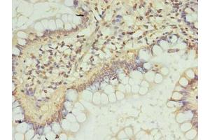 Immunohistochemistry of paraffin-embedded human small intestine tissue using ABIN7151719 at dilution of 1:100 (ZC3H12A anticorps  (AA 1-260))