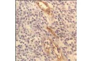 CD62P (P-Selectin) – ABIN118767 - Human tonsil showing capillary endothelium. (P-Selectin anticorps)