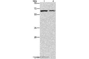 Western blot analysis of Mouse pancreas and human fetal liver tissue, using CBS Polyclonal Antibody at dilution of 1:550 (CBS anticorps)
