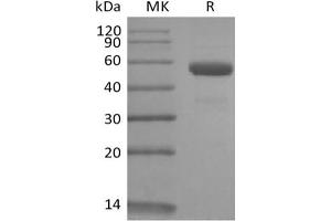 Western Blotting (WB) image for CD79b Molecule, Immunoglobulin-Associated beta (CD79B) protein (Fc Tag) (ABIN7321034)